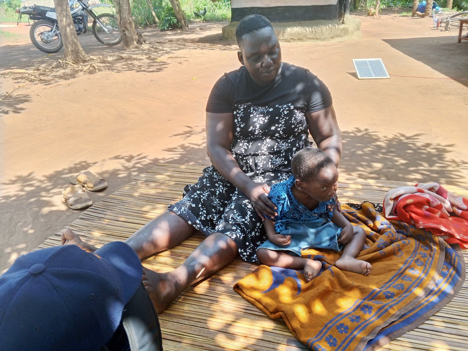 Right for children with disabilities, and provision of nutrition support to this children.