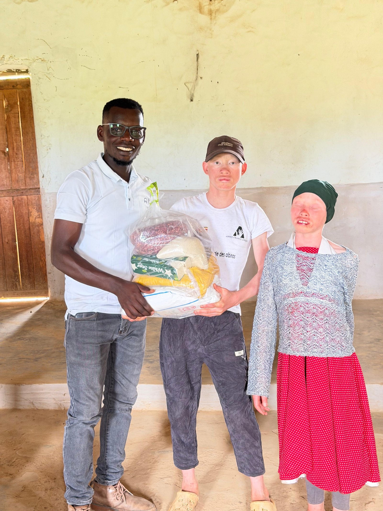 Support the Albino community