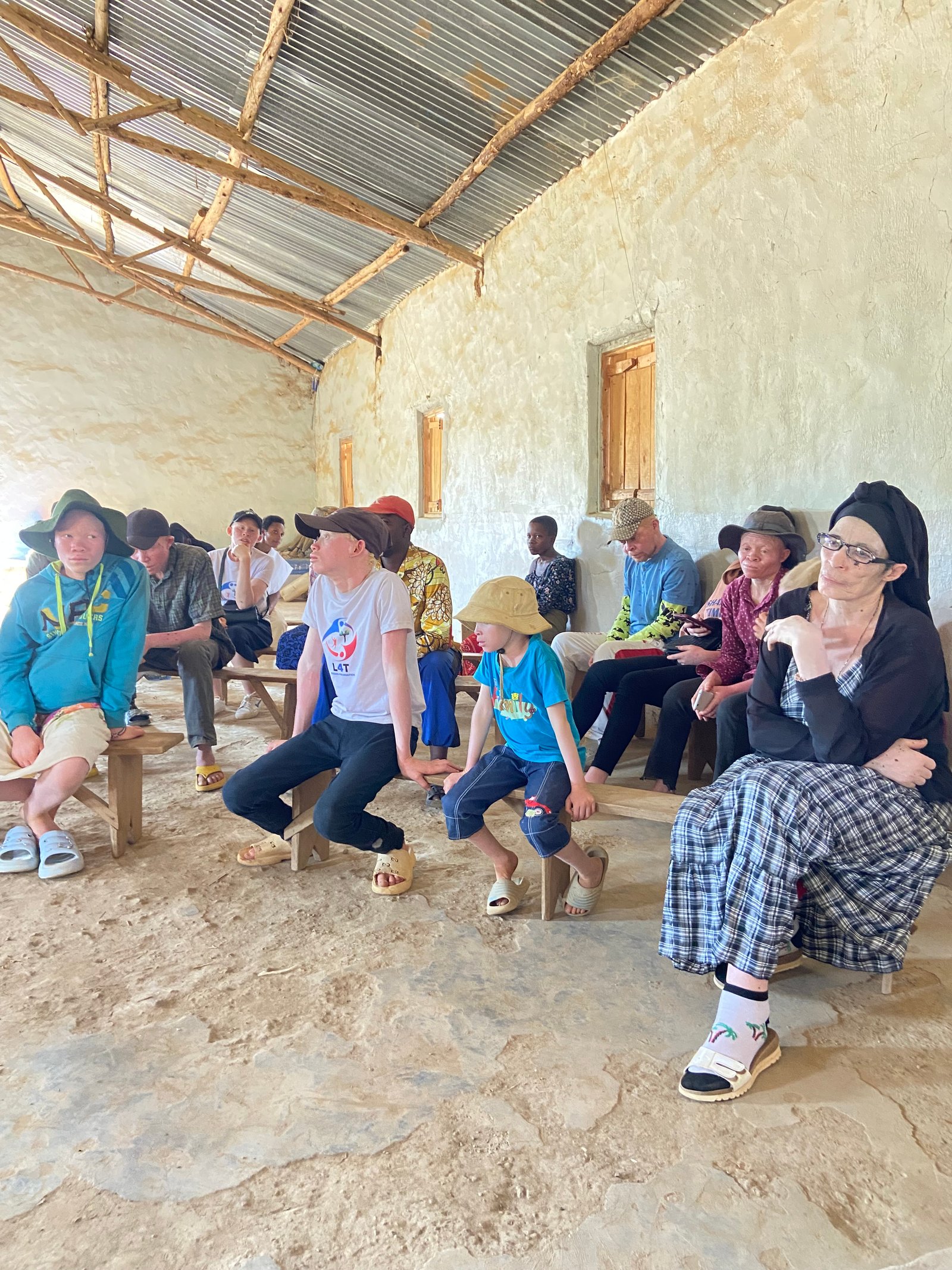 Support the Albino community — photo 2