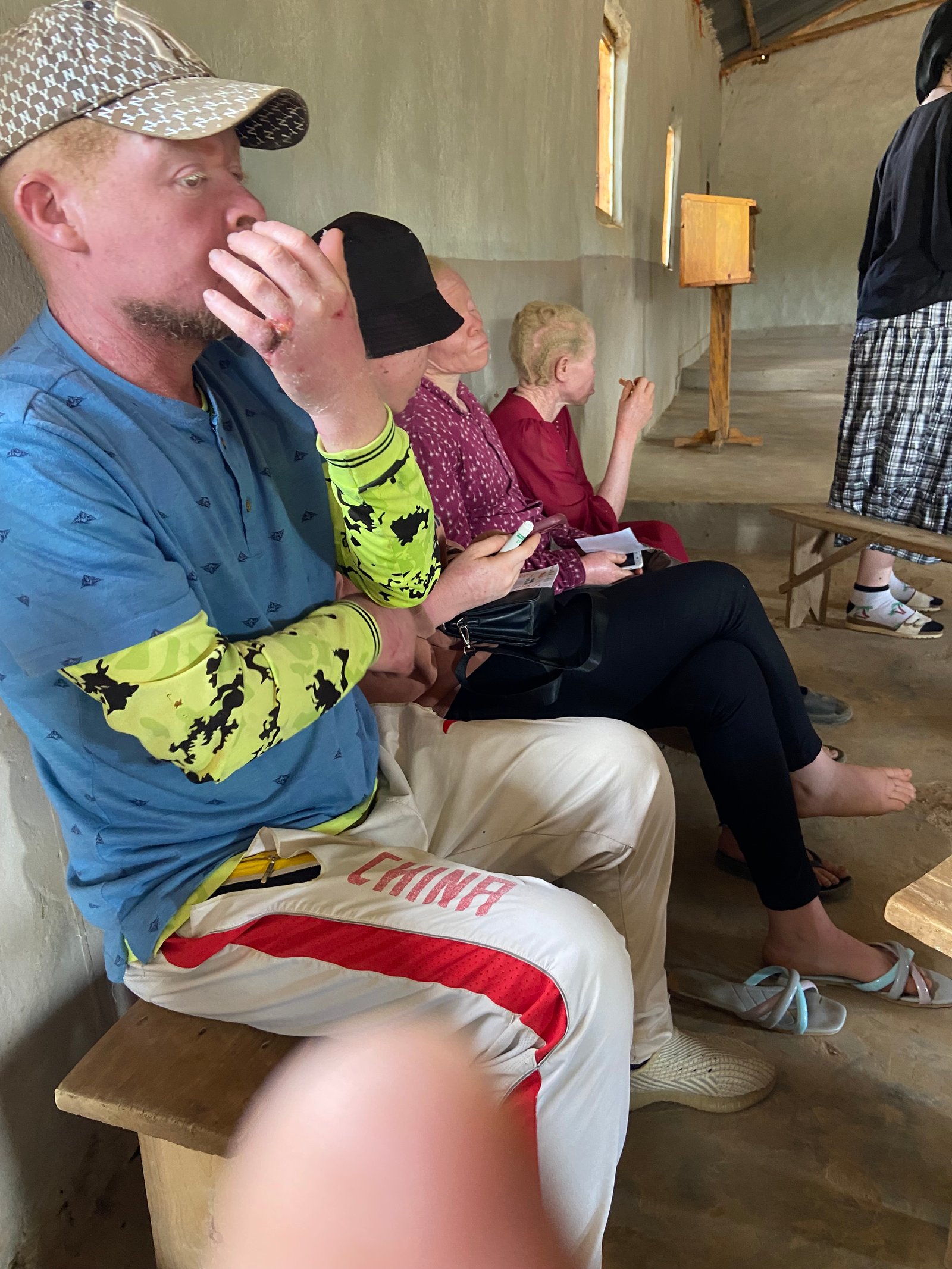 Support the Albino community — photo 3