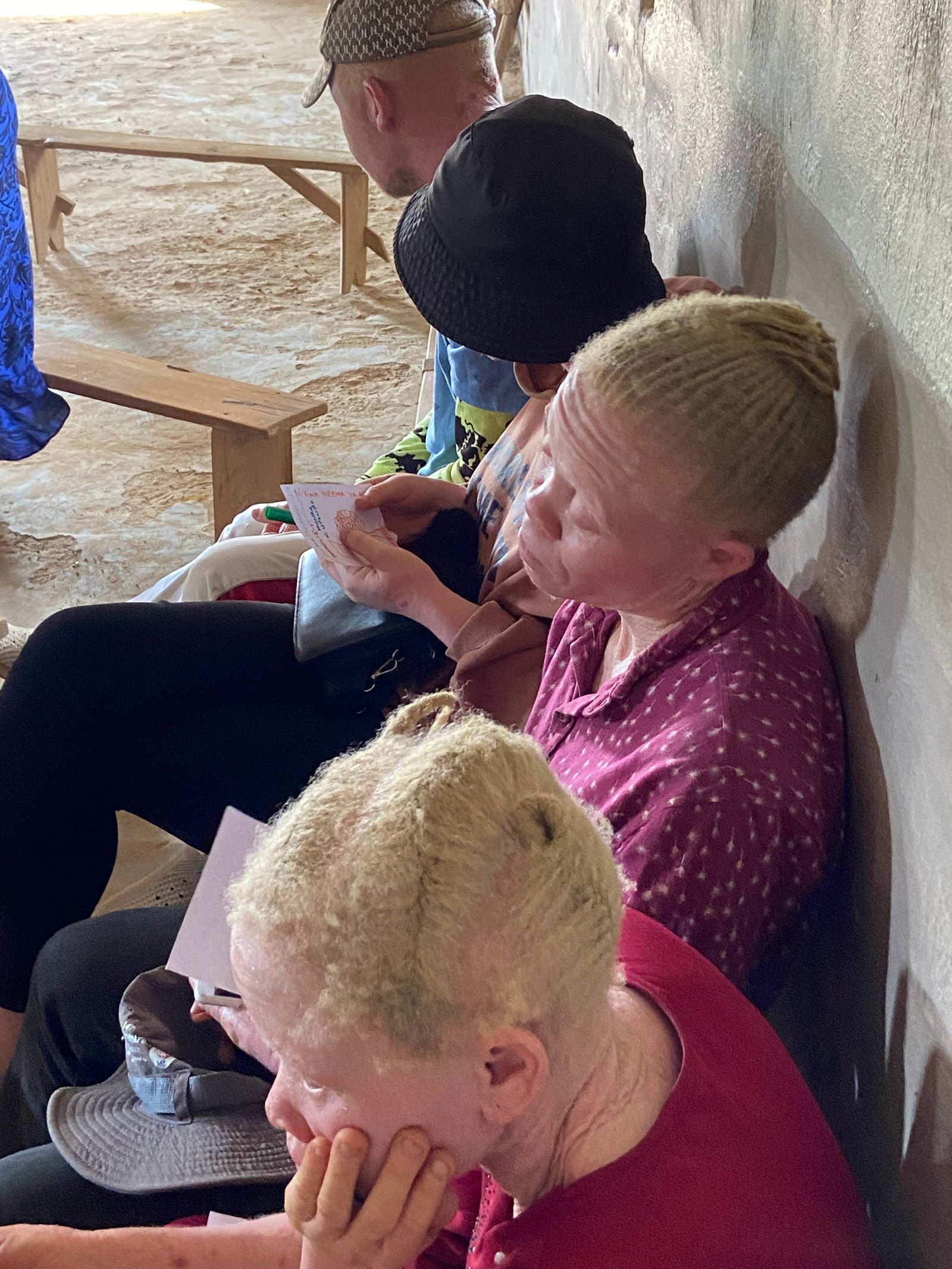 Support the Albino community — photo 5